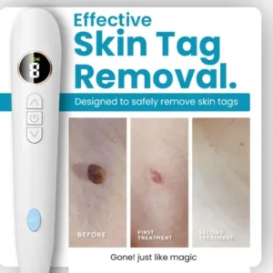 Bikenda® Home Use CO2 Laser Shot Erase Pro