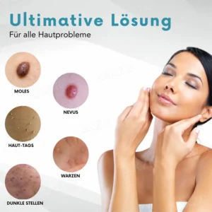 Bikenda® Nicht-invasiv Leberfleck- und Warzenentfernungs-Laserstift