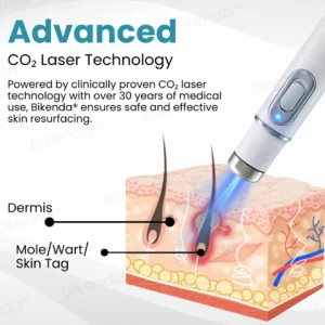 Bikenda® Non-invasive Mole and Wart Removal Laser Pen