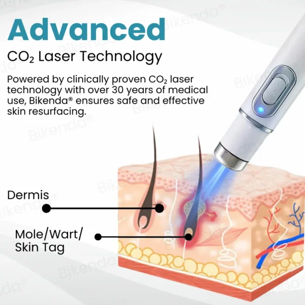 Bikenda® Non-invasive Mole and Wart Removal Laser Pen
