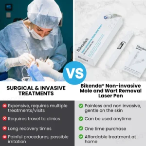 Bikenda® Non-invasive Mole and Wart Removal Laser Pen
