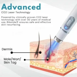 Bikenda® SUPER Non-Invasive Mole and Wart Removal Laser Pen