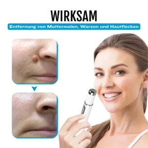 Bikenda® SpotlessDerm Molen- und Warzen-Laserstift