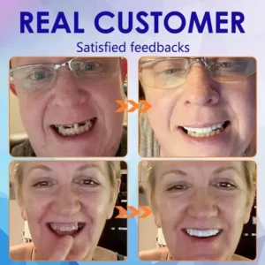 Bikenda®Advanced Full Denture Set