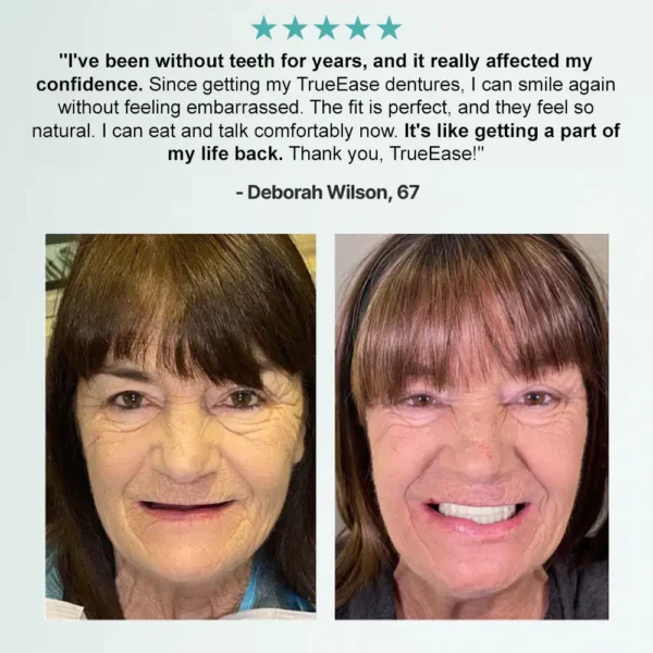 💚🦷𝗕𝗶𝗸𝗲𝗻𝗱𝗮® 𝗔𝗱𝘃𝗮𝗻𝗰𝗲𝗱 𝗖𝘂𝘀𝘁𝗼𝗺𝗶𝘇𝗲𝗱 𝗙𝘂𝗹𝗹 𝗗𝗲𝗻𝘁𝘂𝗿𝗲 𝗦𝗲𝘁  （✅Clinically backed comfort-fit dentures —  Trusted by 8,000+ US users for all-day comfort.）