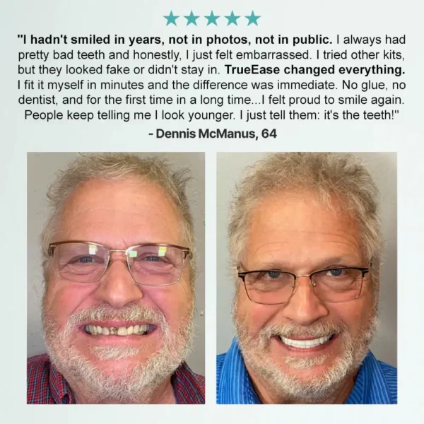 💚🦷𝗕𝗶𝗸𝗲𝗻𝗱𝗮® 𝗔𝗱𝘃𝗮𝗻𝗰𝗲𝗱 𝗖𝘂𝘀𝘁𝗼𝗺𝗶𝘇𝗲𝗱 𝗙𝘂𝗹𝗹 𝗗𝗲𝗻𝘁𝘂𝗿𝗲 𝗦𝗲𝘁  （✅Clinically backed comfort-fit dentures —  Trusted by 8,000+ US users for all-day comfort.）