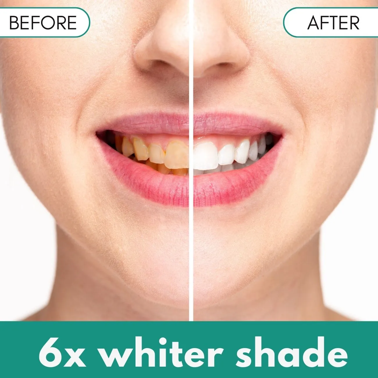 🌟 Official Store | Bikenda® Plaque & Stain Remover – Reveal Your Brightest Smile!✨