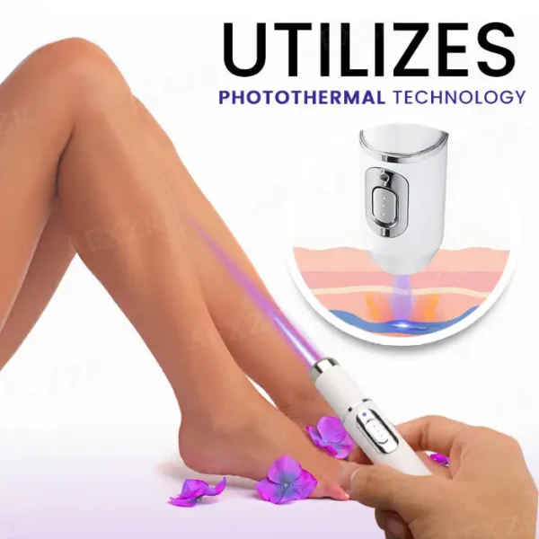 🌟 Official Store | Bikenda® Varicose Vein Photothermal Laser Treatment🔥Say Goodbye to Varicose Veins and Hello to Confidence!