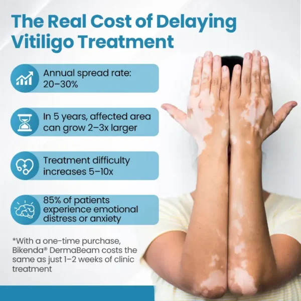 Bikenda® DermaBeam Vitiligo Therapy Device ✅3-5 Second Vitiligo Treatment, Visible Results in Just 2 Weeks