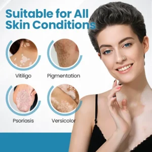 Bikenda® DermaBeam Vitiligo Therapy Device ✅3-5 Second Vitiligo Treatment, Visible Results in Just 2 Weeks