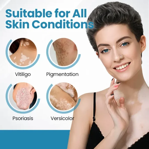 Bikenda® DermaBeam Vitiligo Therapy Device ✅3-5 Second Vitiligo Treatment, Visible Results in Just 2 Weeks