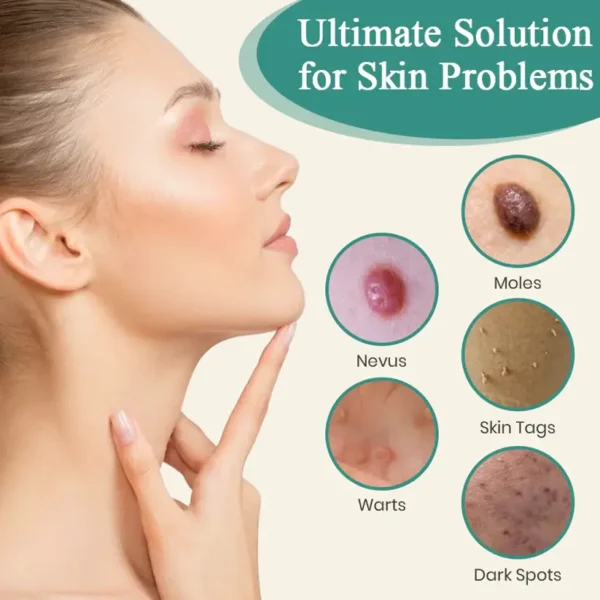 Bikenda® Mole and Wart Instant Removal Laser Pen