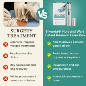 Bikenda® Mole and Wart Instant Removal Laser Pen