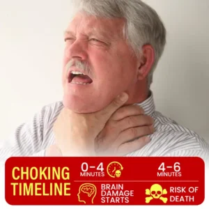 ⏰Last Day Promotion: 70%🎉 Bikenda® LifeAegis Anti-Choking Device
