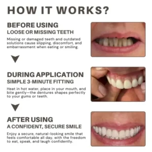 Bikenda® Custom-Fit Full Denture Set