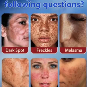 [Official Store] Bikenda™ Blemish Removing Beauty Cream – Fades Dark Spots, Freckles & Wrinkles | Age-Defying, Even-Tone Treatment