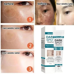 [Official Store] Bikenda™ Blemish Removing Beauty Cream – Fades Dark Spots, Freckles & Wrinkles | Age-Defying, Even-Tone Treatment