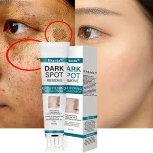 [Official Store] Bikenda™ Blemish Removing Beauty Cream – Fades Dark Spots, Freckles & Wrinkles | Age-Defying, Even-Tone Treatment