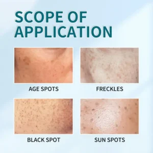 [Official Store] Bikenda™ Blemish Removing Beauty Cream – Fades Dark Spots, Freckles & Wrinkles | Age-Defying, Even-Tone Treatment