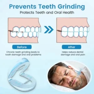 ✨Bikenda® DreamGuard: Anti-Snoring & Teeth Grinding Teeth Protector