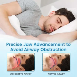 ✨Bikenda® DreamGuard: Anti-Snoring & Teeth Grinding Teeth Protector