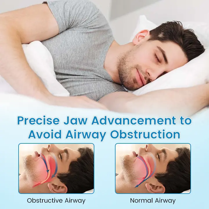 ✨Bikenda® DreamGuard: Anti-Snoring & Teeth Grinding Teeth Protector