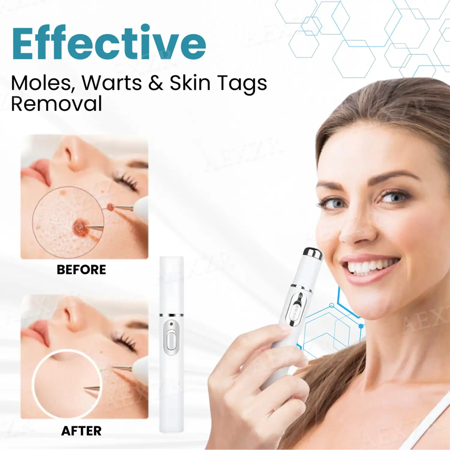 Bikenda® PRO Non-Invasive Mole and Wart Removal Laser Pen