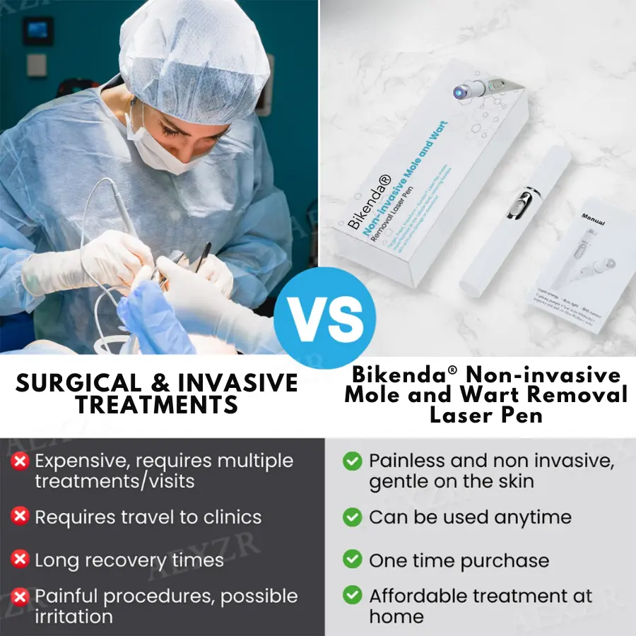 Bikenda® PRO Non-Invasive Mole and Wart Removal Laser Pen