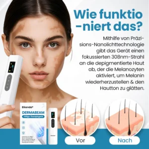 Alternative view of Bikenda® DermaBeam Vitiligo-Therapiegerät